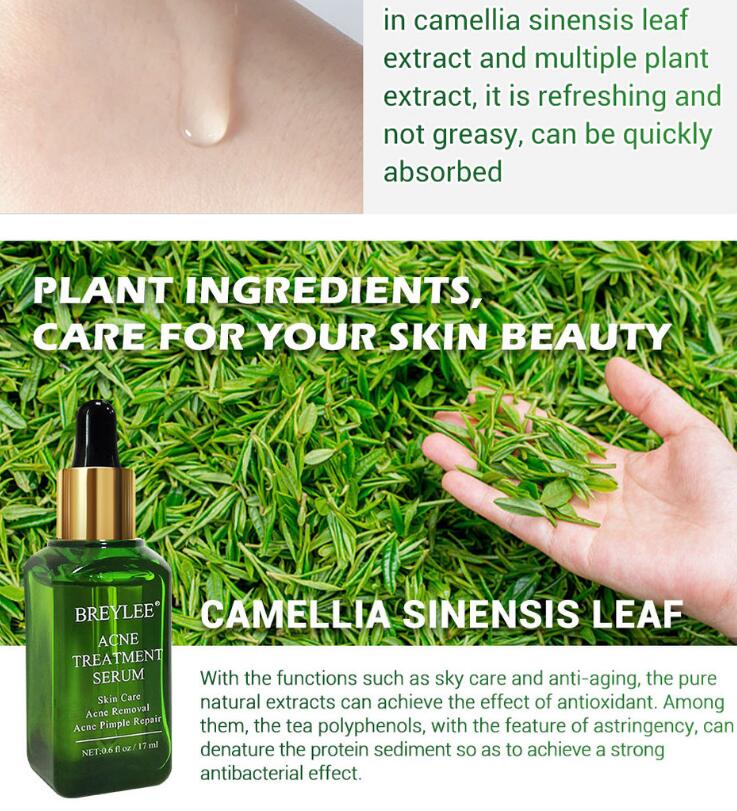 Acne Treatment Serum Facial Repair Oil for daily skincare