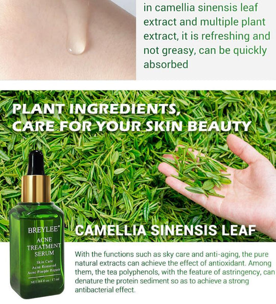 Acne Treatment Serum Facial Repair Oil for daily skincare