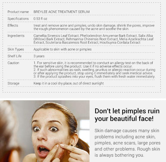 Acne Treatment Serum Facial Repair Oil facial serum bottle