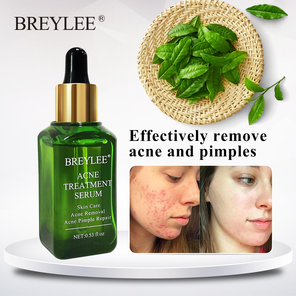 BREYLEE Acne Treatment Serum for Acne Scar & Pimple Repair, effective skin care for acne and pimples.