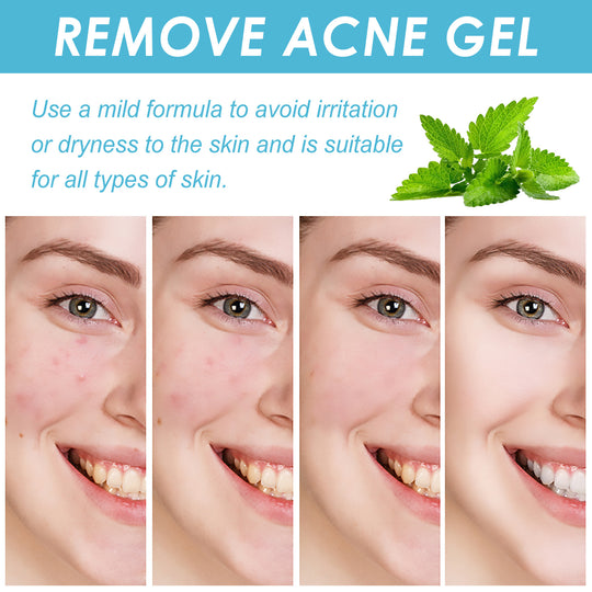 Salicylate Acne Repair Gel for clearer skin