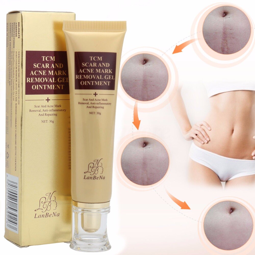 Acne Scar Removal Cream Skin Repair Cream for blemish care