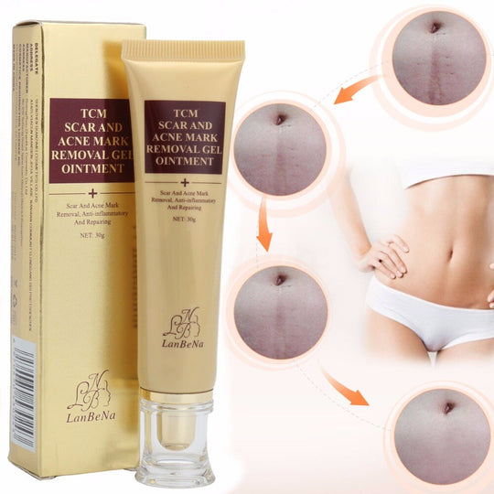 Acne Scar Removal Cream Skin Repair Cream for blemish care