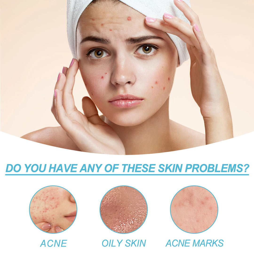 Salicylate Acne Repair Gel skincare product tube