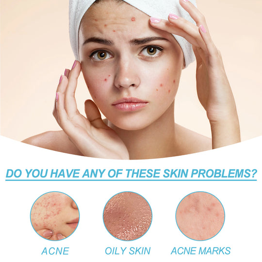 Salicylate Acne Repair Gel skincare product tube