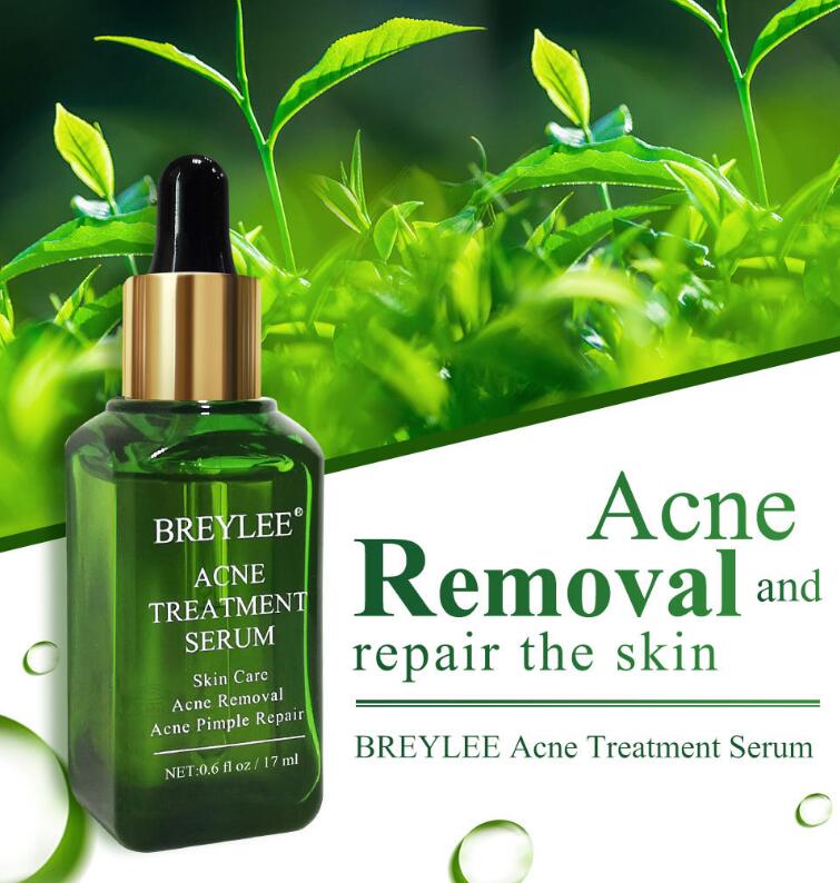 Acne Treatment Serum Facial Repair Oil for acne-prone skin
