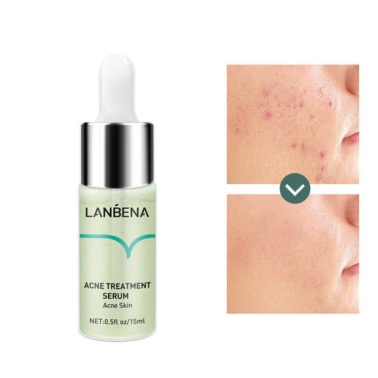 Lambina Anti Acne Liquid for daily skin repair