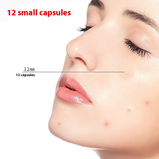 Invisible Repair Pus Absorption Acne Cover Patch Isolation on facial skin