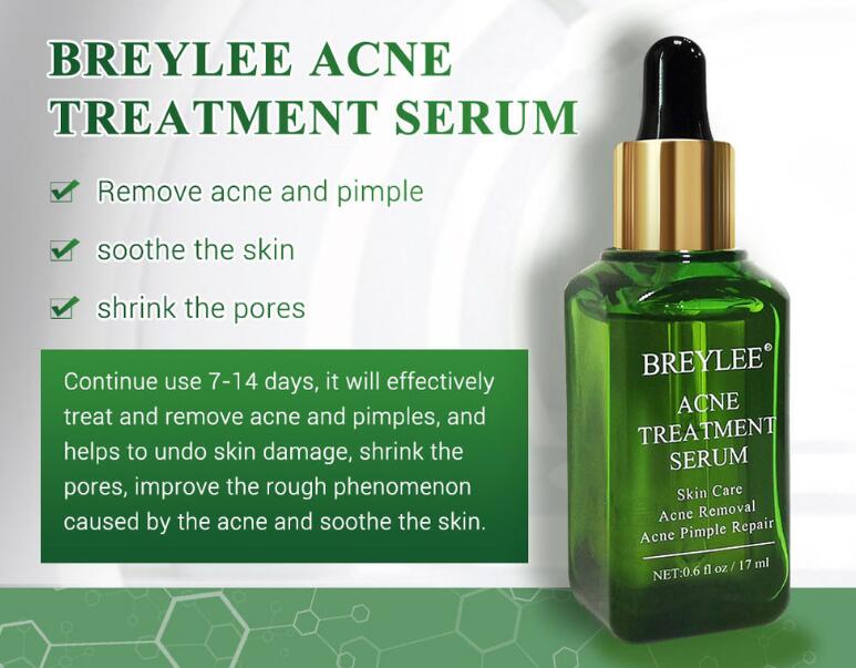 Acne Treatment Serum Facial Repair Oil for repairing acne marks
