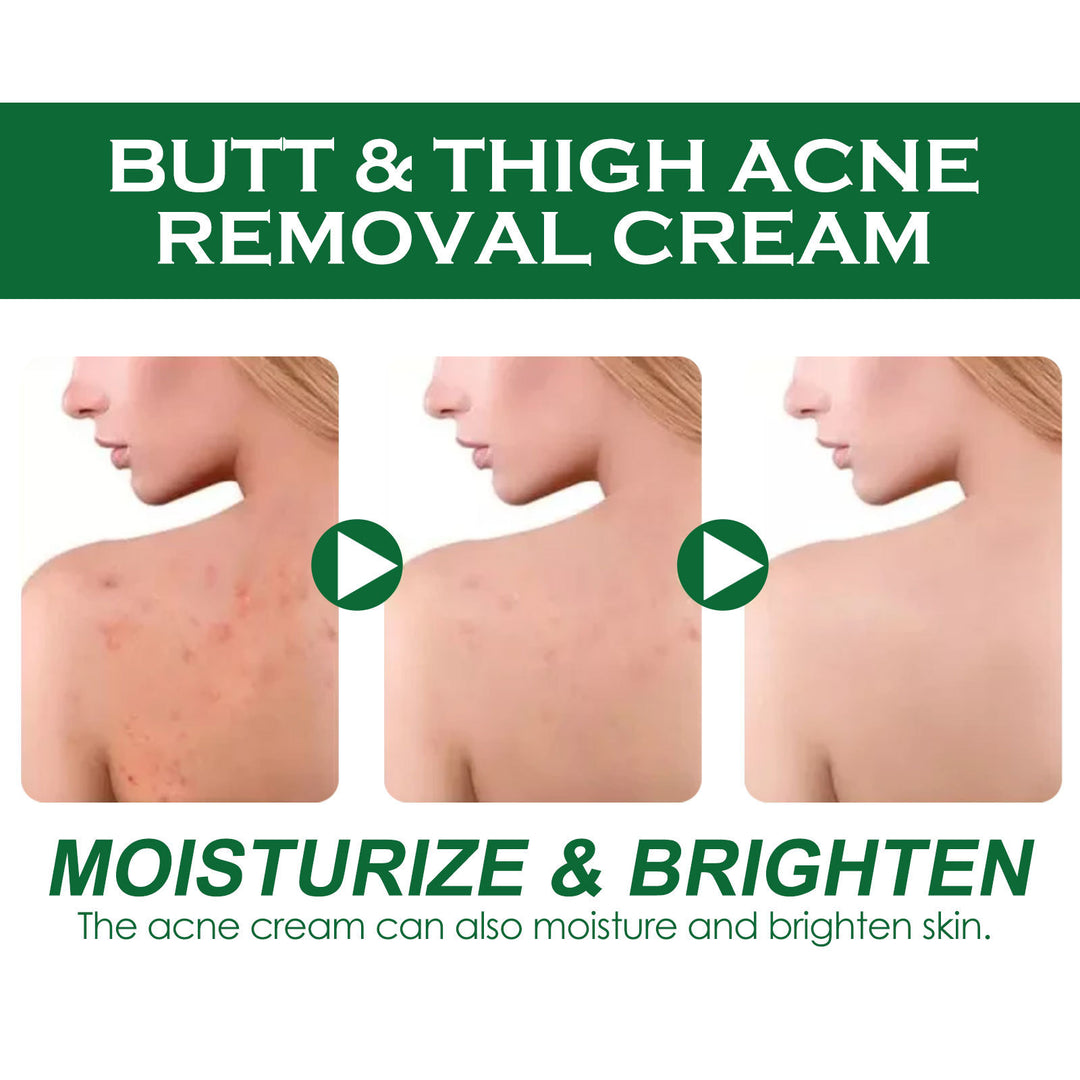 Clean And Repair Acne Smooth Skin Neck Cream for smooth skin