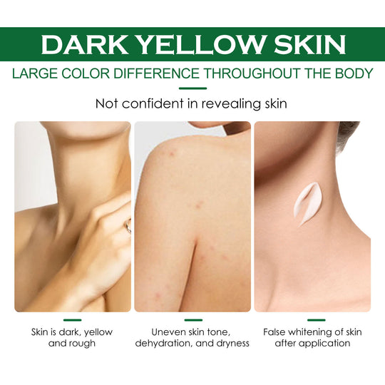 Clean And Repair Acne Smooth Skin Neck Cream body acne treatment