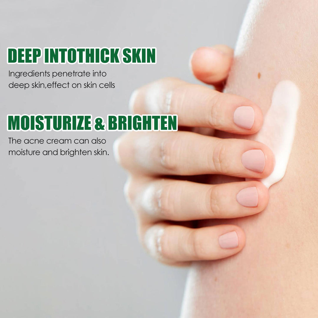 Clean And Repair Acne Smooth Skin Neck Cream with natural extracts