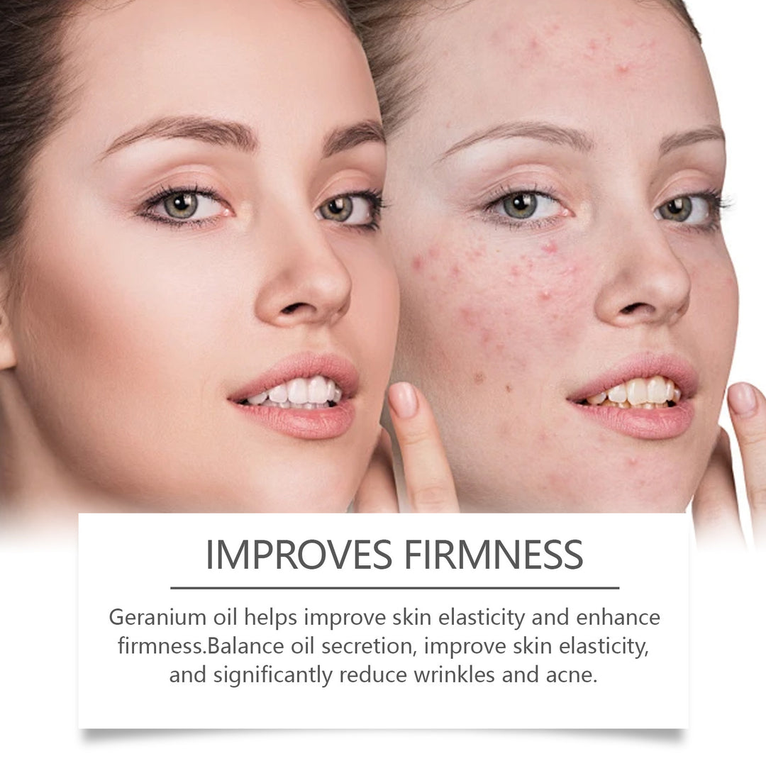 Retinol Oil Repair Facial Acne Skin for smoother skin