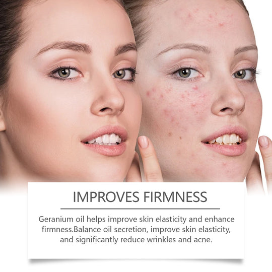 Retinol Oil Repair Facial Acne Skin for smoother skin