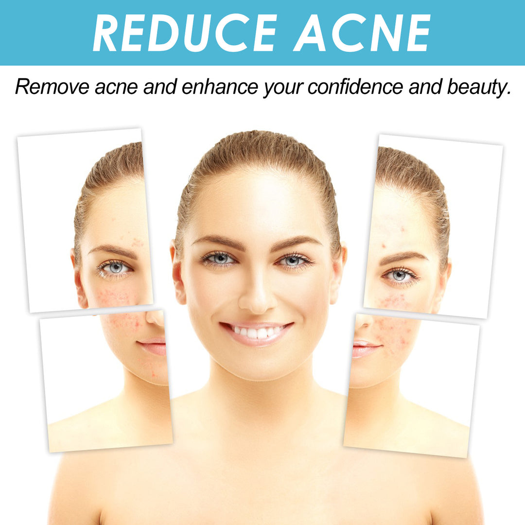 Salicylate Acne Repair Gel for daily skincare