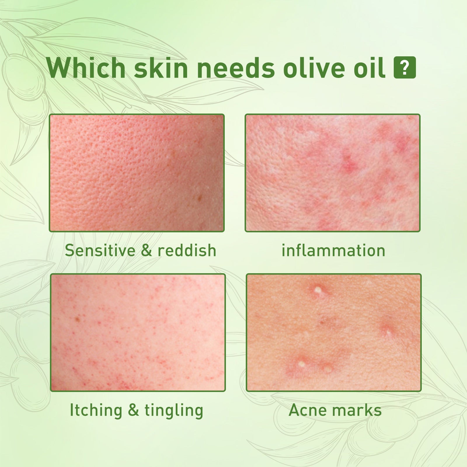 Acne Clarifying Oil for daily skin repair