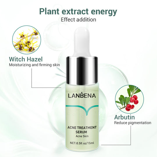 Lambina Anti Acne Liquid for acne treatment
