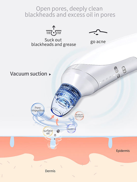 Blackhead Remover Device blackhead removal tool